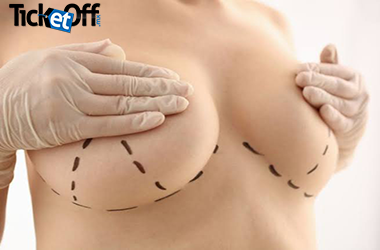 Implantes de mama