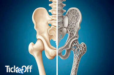 Consulta de prevención, detección y tratamiento de osteoporosis